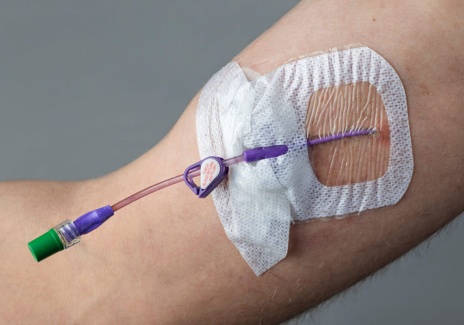 A person is holding an iv in their arm.